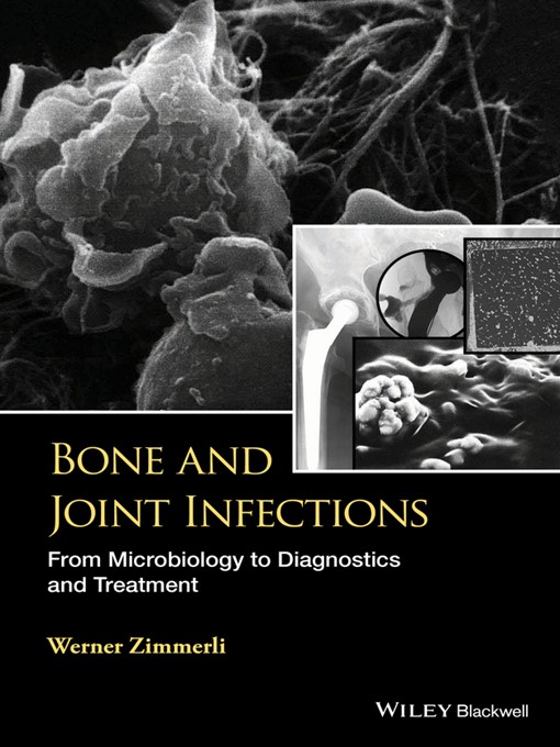 Title details for Bone and Joint Infections by W. Zimmerli - Available